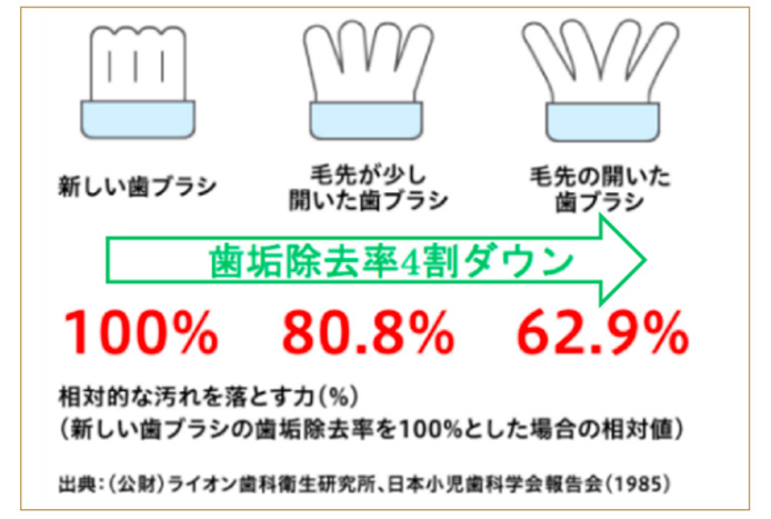 歯ブラシの交換時期