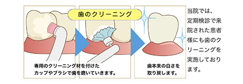 本来の白さを取り戻すクリーニング