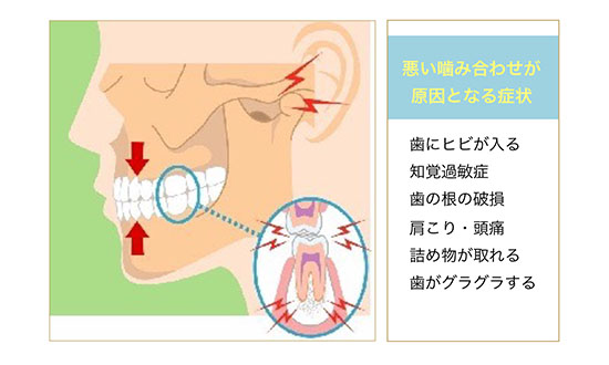 大切な正しい噛み合わせ 