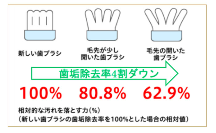 適切な歯ブラシ選びと交換時期