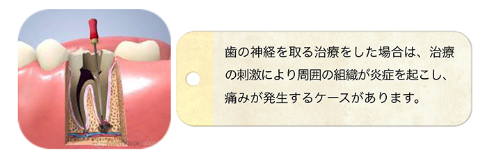 治療後の痛みについて②