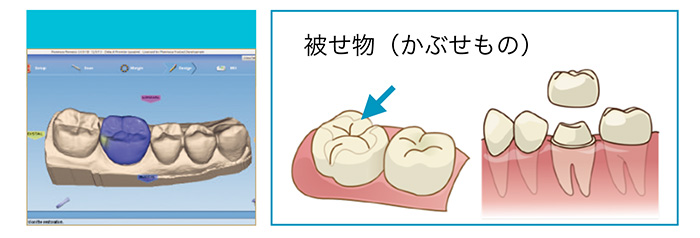 最先端歯科治療システム導入②