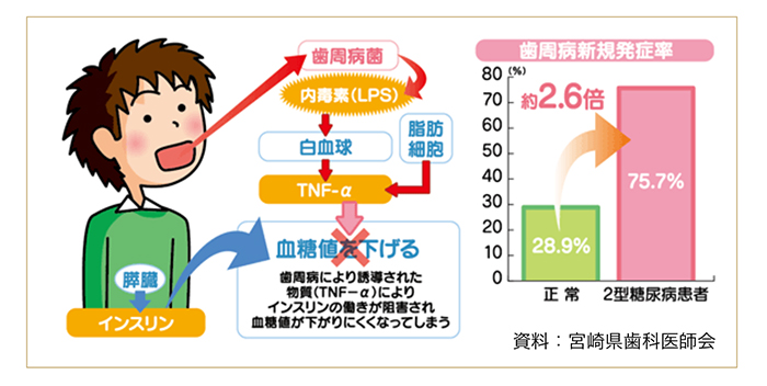 シリーズ①歯周病と全身疾患 ～糖尿病～