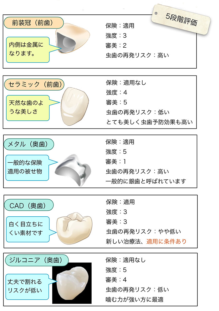 被せ物の種類と特徴