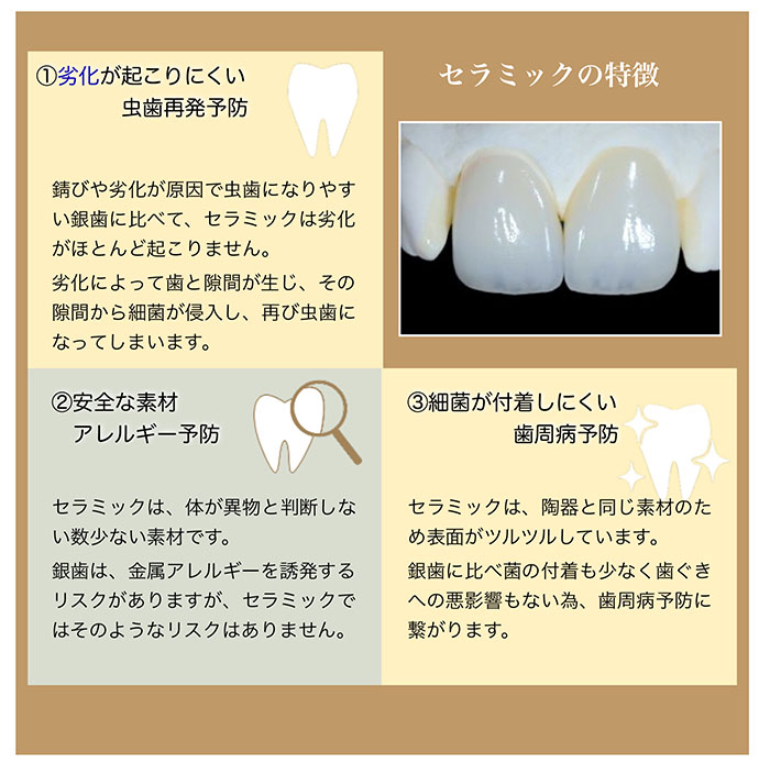 健康につながるセラミック治療の特徴